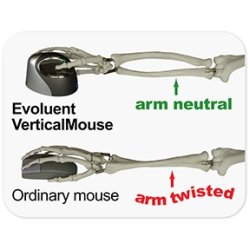 Evoluent VerticalMouse 4, vlg hjre / venstrehnd